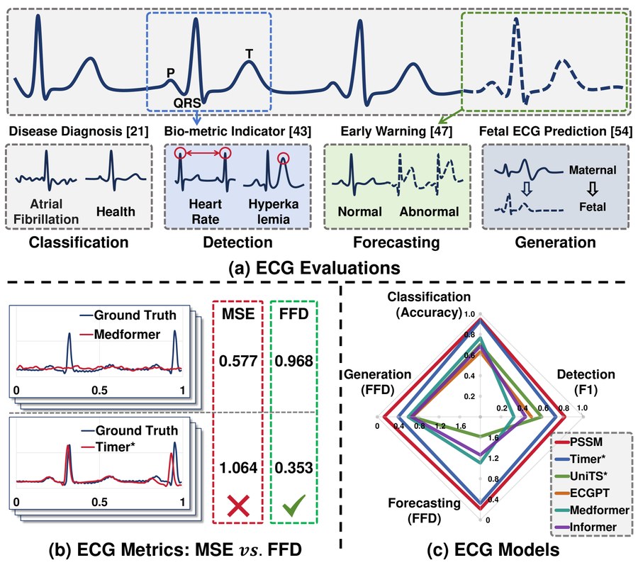 A Comprehensive Benchmark for Electrocardiogram Time-Series 